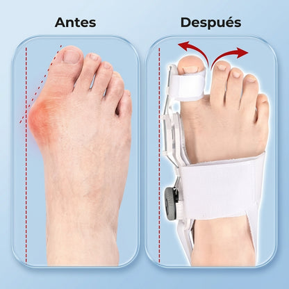 OrthoCare™ |Corrector de Juanetes